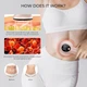 Аппарат для удаления целлюлита Depsoul Cellulite Machine 4 в 1 - изображение 2