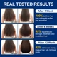 Масло для роста и укрепления волос Hair Growth Oil 3-in-1 Castor Oil + Biotin + Minoxidil 5% Sefudun , 60 ml - изображение 8