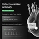 Умные весы WITHINGS Body Scan с биоимпедансом Black - изображение 4