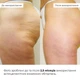 Набір антицелюлітних розігрівальних обгортань Hillary Heating Anti-Cellulite Wrap Set K-11-672 - зображення 11