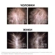 Сыворотка Vichy Dercos Aminexil Clinical Regen Booster для восстановления густоты и борьбы с выпадением волос 90 мл (3337875932080) - изображение 4