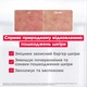 Многофункциональный восстанавливающий бальзам Mixa Cica Balm+ для раздраженной сухой чувствительной кожи младенцев, детей и взрослых 50 мл (3600551183381) - изображение 7