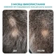 Biotrade (Біотрейд) Sebomax HR Anti-Hair Loss Gel – стимулювальний гель проти випадіння волосся, 26 мл - зображення 2