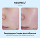 Увлажняющие пады для лица Medi-Peel Mooltox Glow Moisturizing Pad 2x, 50 шт - изображение 4
