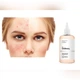 Оновлюючий тонік із гліколевою кислотою The Ordinary Glycolic Acid 7% Exfoliating Toner 240 мл - зображення 2