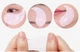Гидрогелевые патчи Medi-Peel Hyaluron Dark Benone Peptide 9 Ampoule Eye Patch от темных кругов с пептидами 60 шт - изображение 5