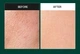 Мягкая пилинг-сыворотка Medi Peel Phyto Cica-Nol B5 6000 Shot Serum с двойной концентрацией спикул и центеллы 50 мл - изображение 2