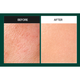 Мягкая пилинг-сыворотка Medi Peel Phyto Cica-Nol B5 6000 Shot Serum с двойной концентрацией спикул и центеллы 50 мл - изображение 5