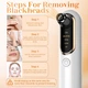 Вакуумный очиститель пор Yccu Blackhead Remover Y002 Белый 4 насадки 4 режима USB зарядка (614141562916) - Уценка - изображение 4
