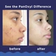 Пенка для умывания от акне, для лица и тела Panoxyl Acne foaming wash 28 гр - изображение 2