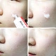 Крем для лица Medi Peel AHA BHA 28 Days Hyal Cream 30ml - изображение 4