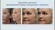 Зволожувальний денний крем для обличчя Resurface Dr. C. Tuna, 50 мл - изображение 5