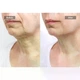 Маска для шиї та декольте із лазерною терапією Jovs Skincare Neck LED Mask - изображение 2
