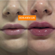 Інтенсивний плампер для губ з мікроголками VT COSMETICS Reedle Shot Lip Plumper Expert 4,3 г - зображення 4