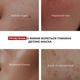 Глиняна маска для обличчя Hillary Anti-Acne детокс для проблемної шкіри очищення акне 90 мл (652933) - зображення 5