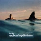 Dua Lipa - Radical Optimism (Светло-голубой, Синий, Альбом) - изображение 11