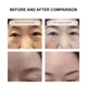 Secret Strips Anti-Wrinkle Skin Strips and Serum — пластыри для лица от морщин между бровями и на лбу с сывороткой, Для лифтинга и обновления кожи, 10 шт. + 8 мл - изображение 6
