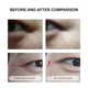 Secret Strips Anti-Wrinkle Smile Line Patches — пластыри от морщин вокруг глаз с сывороткой для лифтинга и обновления кожи, 10 шт. + 8 мл - изображение 3