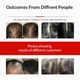 Лазерная кепка для роста волос Без бренду (Red Light Therapy), Аккумуляторная, От выпадения волос - изображение 4