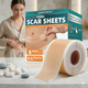 Силіконовий пластир від рубців та шрамів Carvenchy Premium Silicone Scar Sheets (рулон 4см х 150см) - изображение 1
