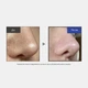 MEDICUBE One Day Exosome Shot Pore Ampoule 2000 Сыворотка с экзосомами и спикулами для сужения пор 2000 - изображение 4