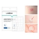 Гидроколлоидные патчи Lanbena Acne Pimple Patch Night Use 28 шт от прыщей и угрей против акне ночные - изображение 5