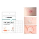 Гидроколоидные патчи Lanbena Acne Pimple Patch 25 шт от прыщей и угрей против акне дневные - изображение 2