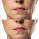 Микротоковый RF лифтинг массажер для лица MEDICA+ Skin Lifting 7.0 White EMS LED - изображение 11