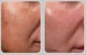 Двухфазная anti–age Medi-Peel Peptide 9 Volume Lifting All-In-One Podo Ampoule Pro 30 мл - зображення 4