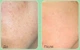 Пилинг-сыворотка со спикулами и центеллой Medi-Peel Phyto Cica-Nol B5 3000 Shot Serum 50 г - изображение 4