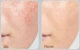 Осветляющая ампула с 20% ниацинамидом Medi-Peel Peptide 9 Vitanol Ampoule Pro 30 мл - изображение 4