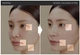 Лифтинг–ампула с ретинолом Medi-Peel Retinol Collagen Lifting Ampoule 50 мл - изображение 4