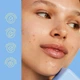 Успокаивающий тонер для проблемной кожи Byoma Blemish Redness Relief Soothing Toner 100 мл - изображение 5