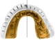 Капа Opro Gold Braces під брекети доросла вік 11+ Clear (102506006) (Gold_Braces_Clear) - зображення 5