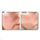 Сироватка з азелаїновою кислотою Medicube Azelaic Acid 16 BB Calming Serum 30 мл - зображення 2