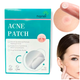 Патчи от прыщей и акне противовоспалительные 72 шт Acne Patch LS-1048 - изображение 1