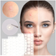 Патчи от прыщей и акне противовоспалительные 72 шт Acne Patch LS-1048 - изображение 2