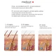 Фотоэпилятор Medica+ ICE PRO 10X, IPL, охлаждение, 500000 вспышек - изображение 8