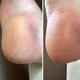 Крем от трещин для рук и стоп Resultum Anti Crack Cream Jojoba из жожоба, 25 мл - изображение 5