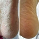 Крем от трещин для рук и стоп Resultum Anti Crack Cream Jojoba из жожоба, 25 мл - изображение 6