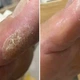 Крем от трещин для рук и стоп Resultum Anti Crack Cream Jojoba из жожоба, 25 мл - изображение 7