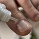 Масло от онихолизиса и грибка Onistopix Oil, 8 мл - изображение 3