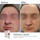 Осветляющий крем BRADERM Tramexal Cream, 30 мл 00-00000388 - изображение 4