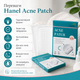 Патчи для лица от прыщей Acne Patch Уход за проблемной кожей 72 шт/1 уп Анти-акне Патчи для лица от прыщей - изображение 6