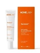 Мягкий пилинг для кожи, склонной к акне ACNELAB+ Spotpeel Soft Peeling, 40 мл (52763948679536) - изображение 2