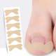 Пластир для корекції врослого нігтя Toenail Correction Sticker 50 шт - изображение 2