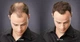 Загуститель для волос Toppik Hair Building Fibers (Auburn) Каштановый - изображение 8