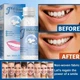 Полимерный гель в гранулах для временного протезирования зубов Moldable False Teeth 30 мл временные зубы - изображение 8