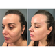 Мікрострумовий ліфтинг Medica+ Skin Lifting 6.0 white - зображення 11