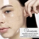 Гидрогелевая био-коллагеновая маска для лица XIOIMY Bio-Collagen Real Deep Mask 1 шт - изображение 3